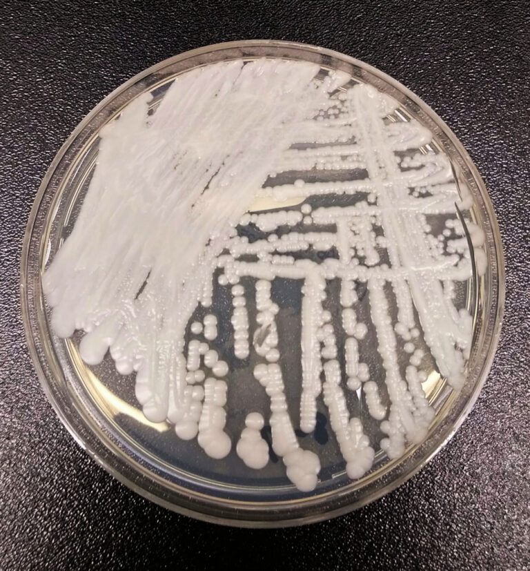 Candidozyma auris (Candida auris)