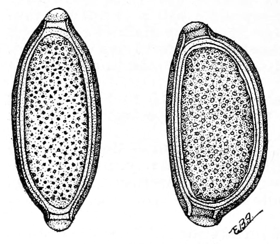 Capillaria contorta