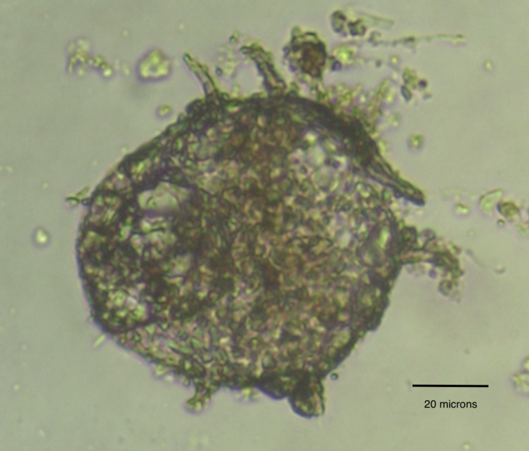 Centropyxis aculeata Centropyxis aculeata