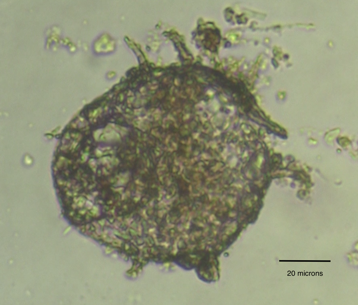 Centropyxis aculeata