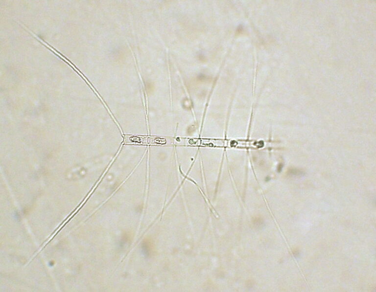 Chaetoceros affinis