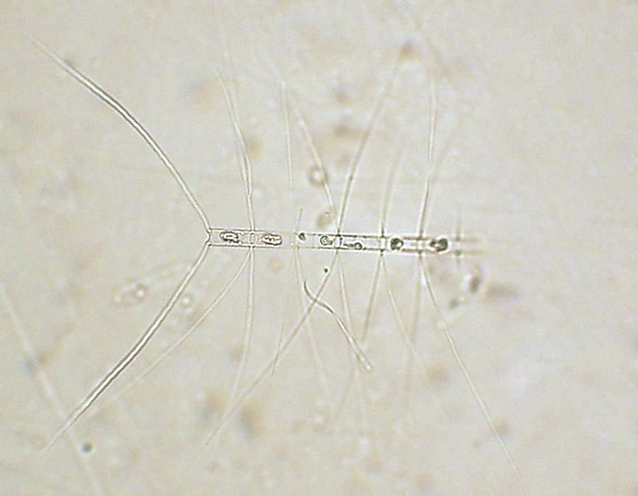 Chaetoceros affinis