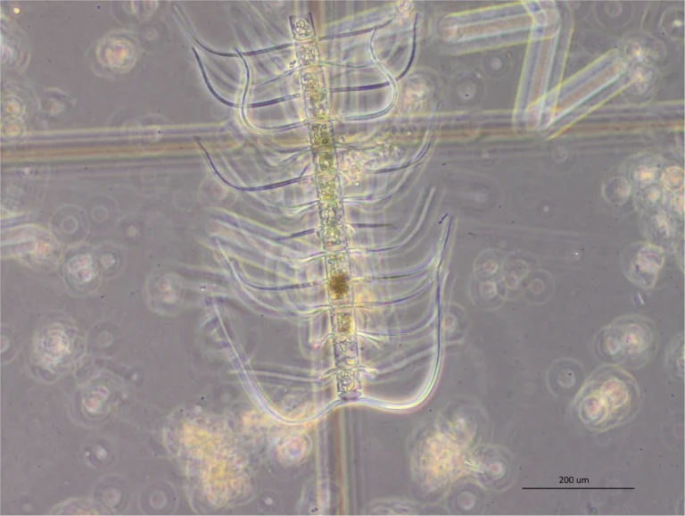 Chaetoceros coarctatus