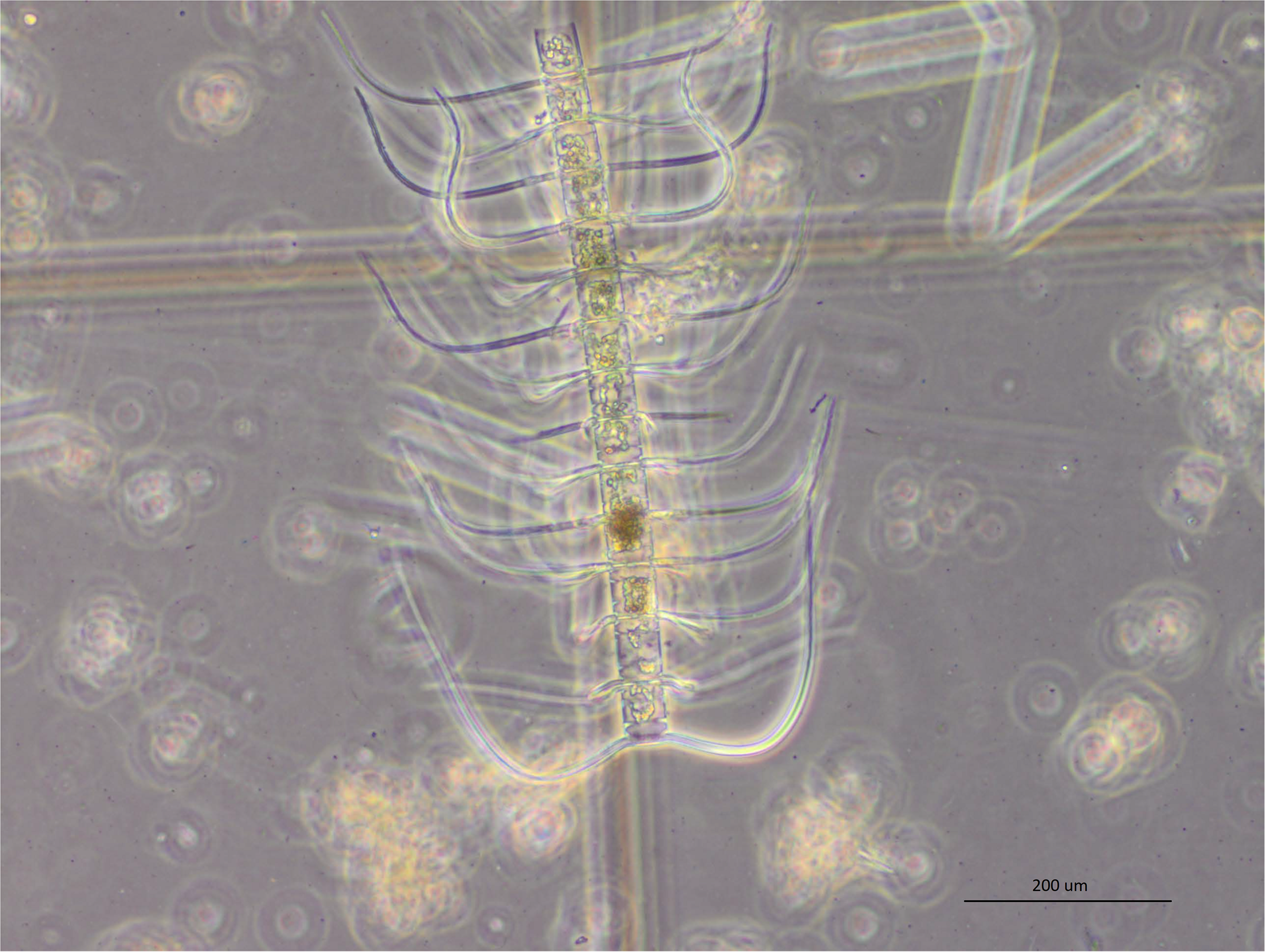 Chaetoceros coarctatus