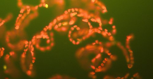 Chaetoceros socialis