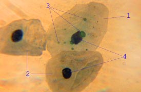 Chlamydophila pneumoniae (Chlamydophila pneumoniae)