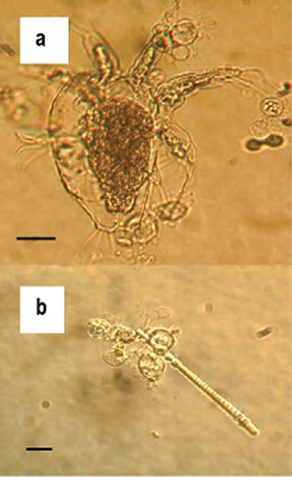 chytridiomykóza obojživelníků (Batrachochytrium dendrobatidis)