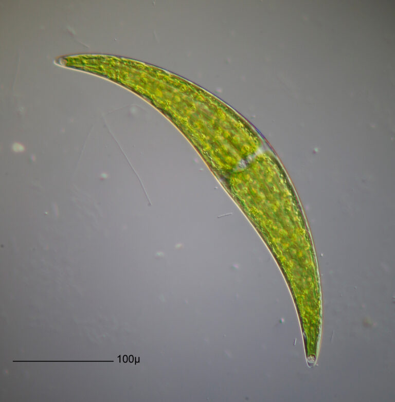 Closterium ehrenbergii