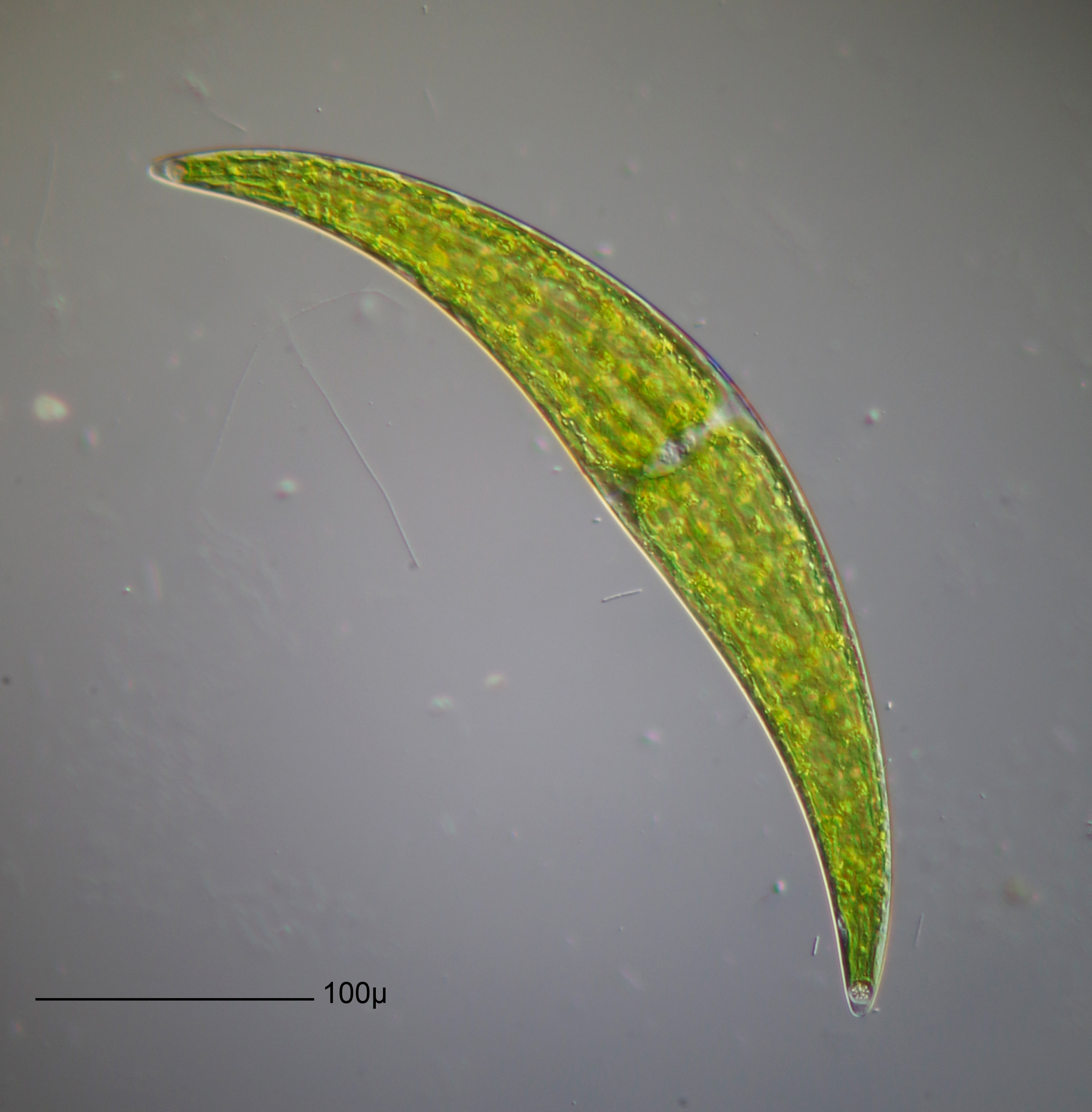 Closterium ehrenbergii