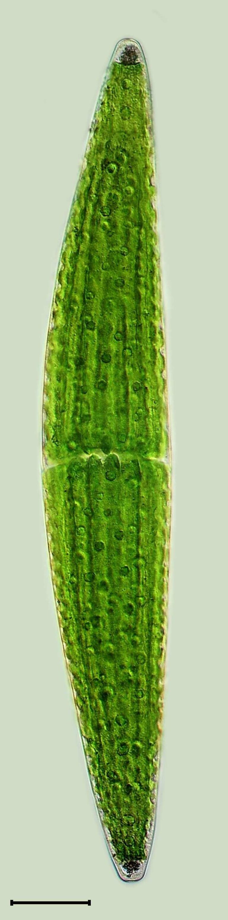 Closterium lunula Closterium lunula