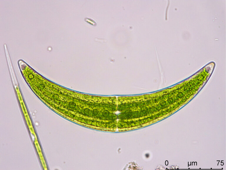 Closterium moniliferum