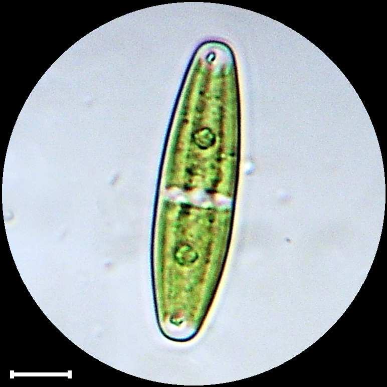 Closterium navicula