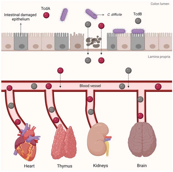 Clostridioides difficile