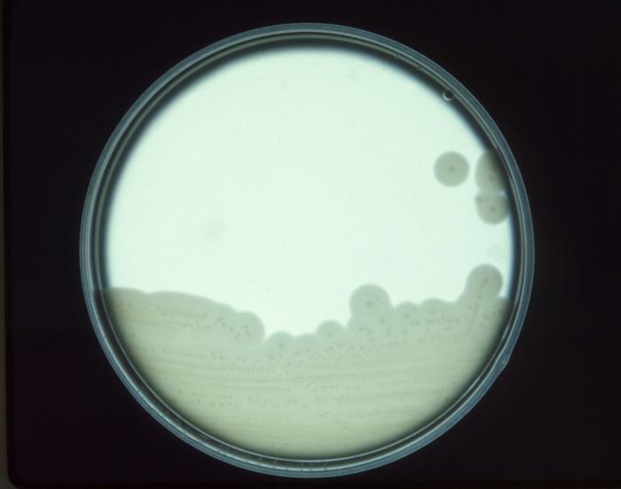 Clostridium perfringens Clostridium perfringens