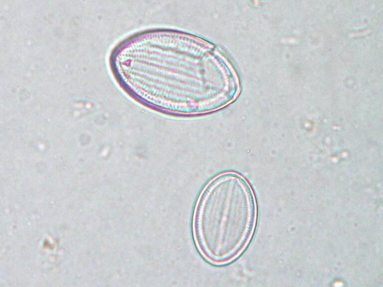 Cocconeis pediculus