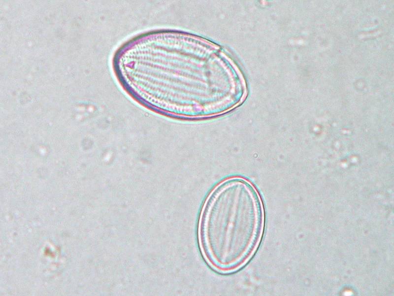 Cocconeis pediculus