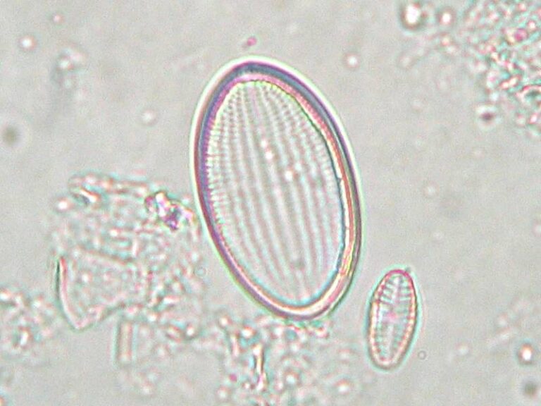 Cocconeis placentula