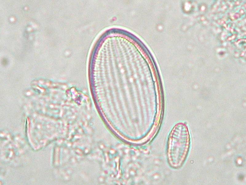 Cocconeis placentula