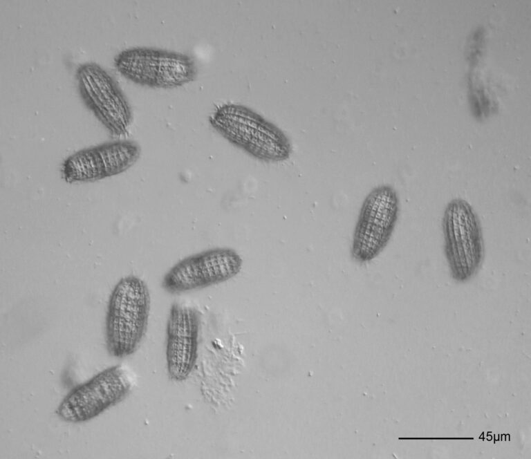 Coleps hirtus