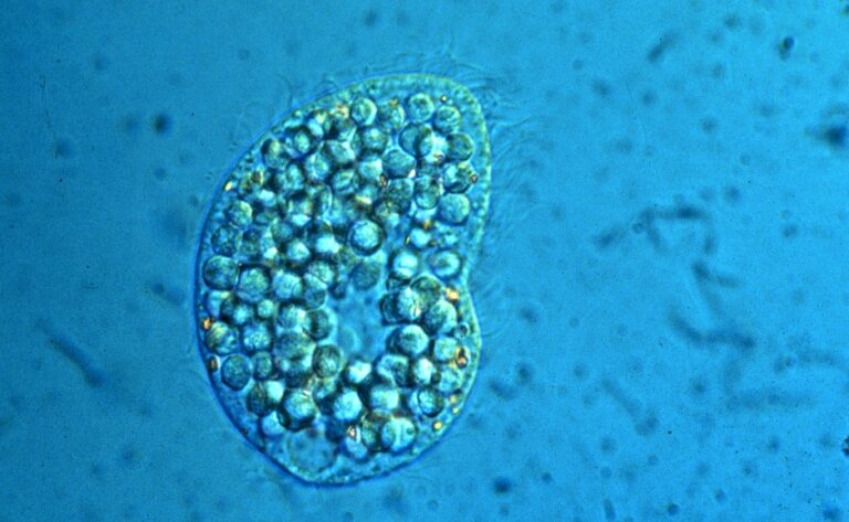 Colpoda inflata Colpoda inflata