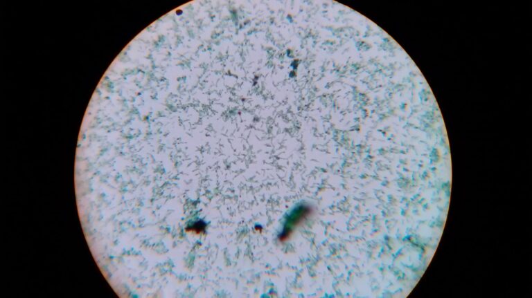 Corynebacterium diphtheriae