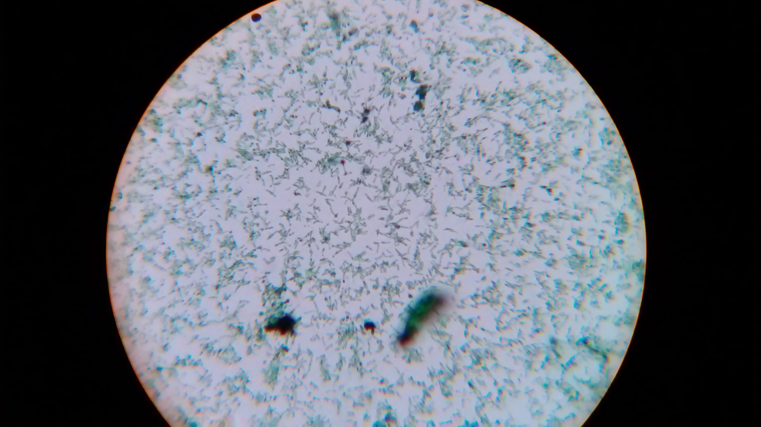 Corynebacterium diphtheriae