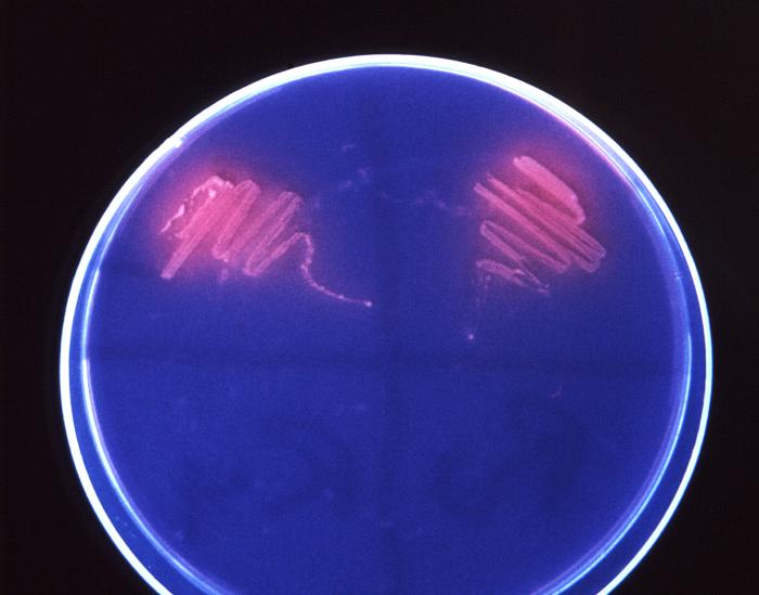 Corynebacterium minutissimum