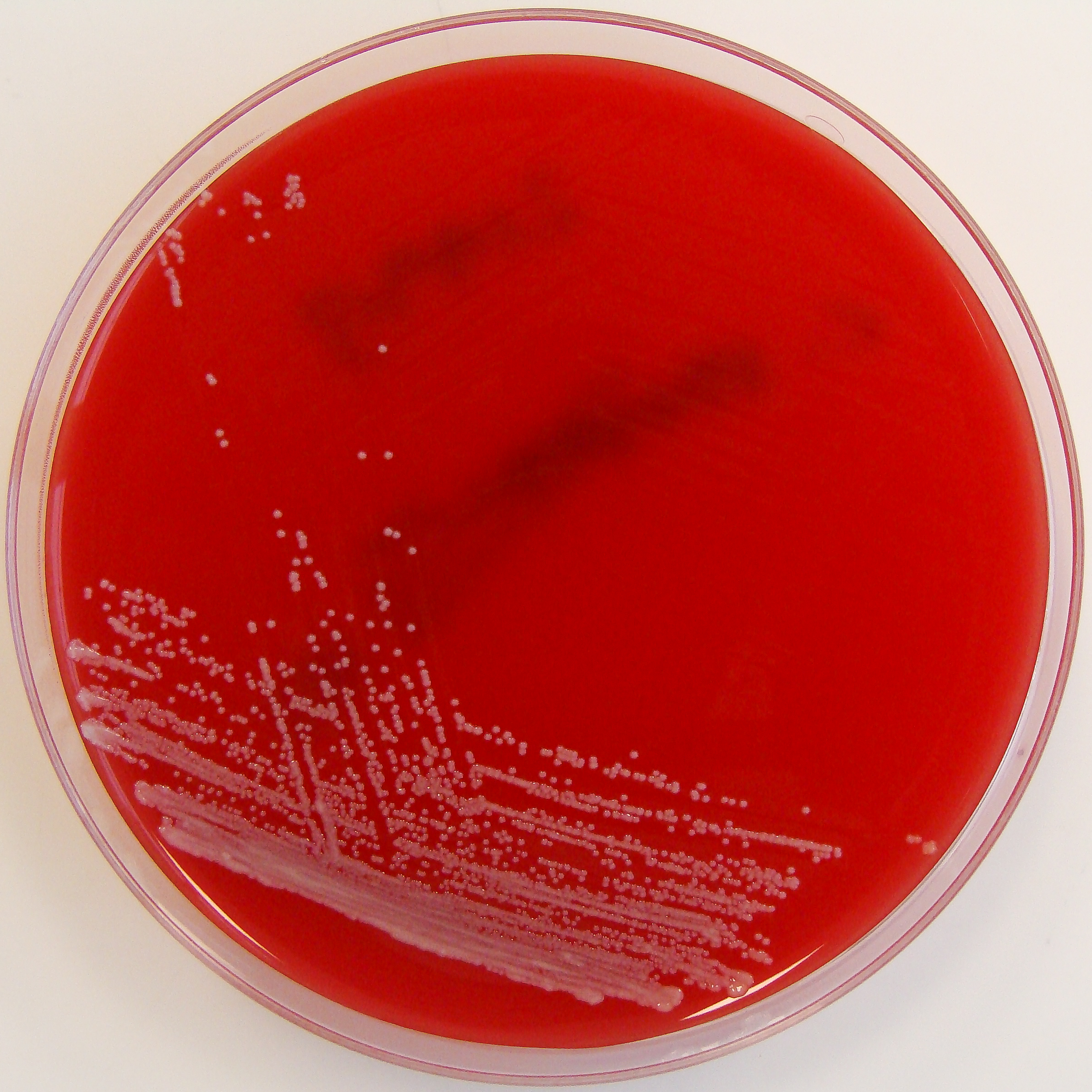 Corynebacterium striatum