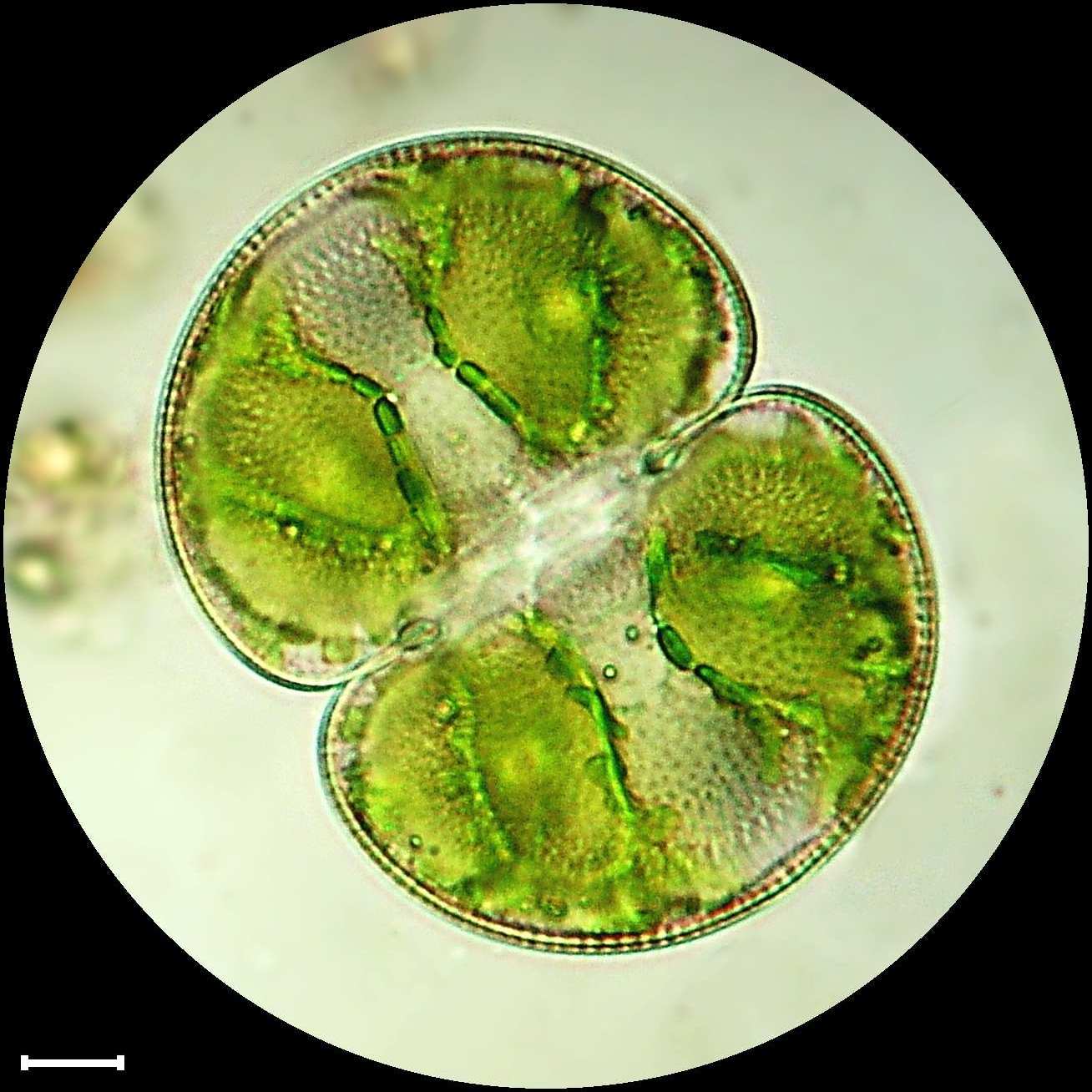 Cosmarium pachydermum