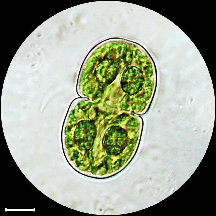 Cosmarium quadratum