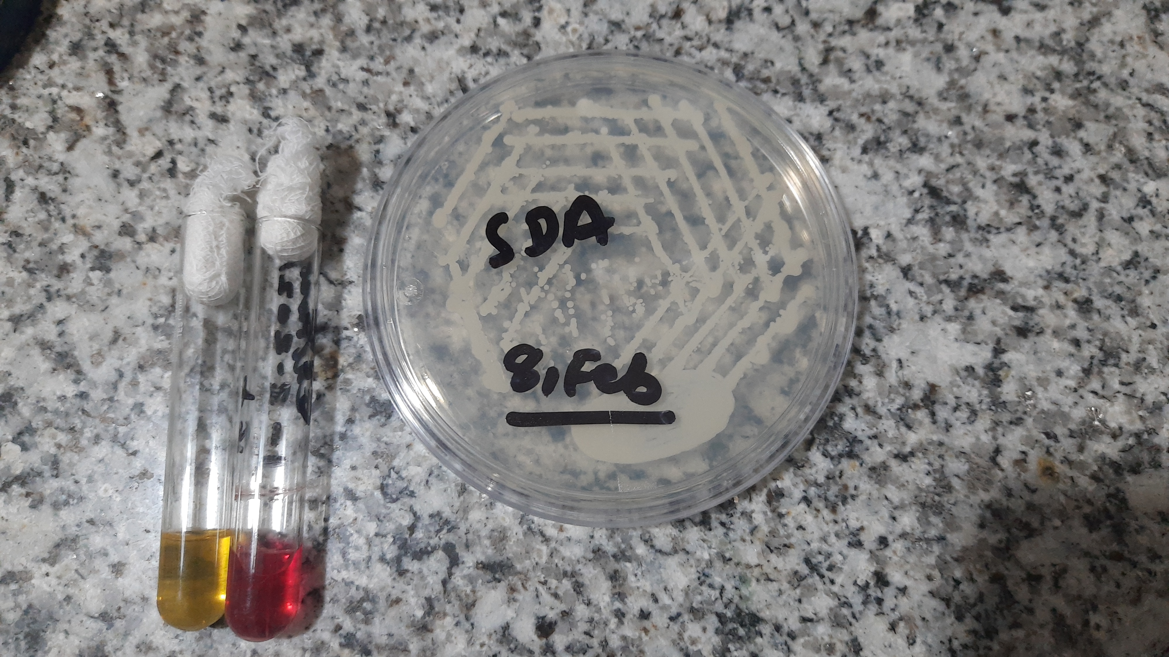 Cryptococcus neoformans