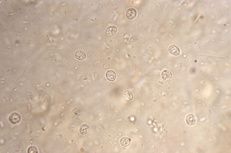 Cryptosporidium parvum