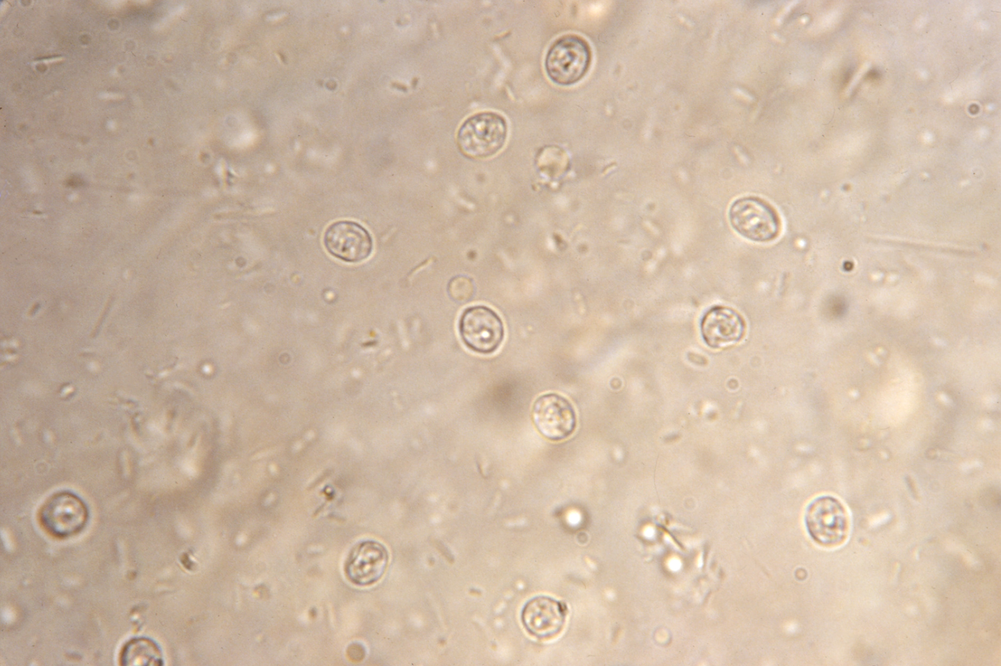 Cryptosporidium parvum