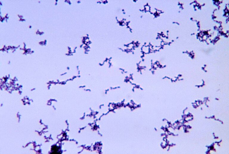 Cutibacterium acnes