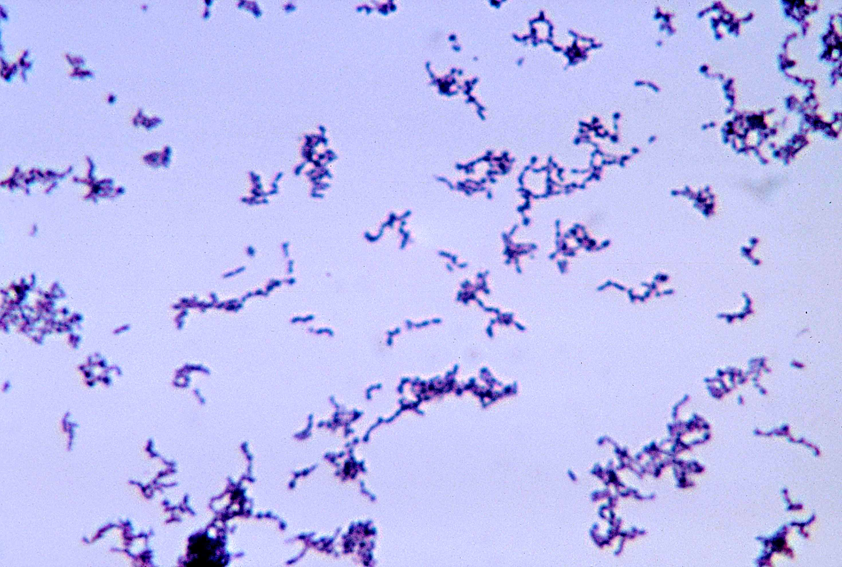 Cutibacterium acnes