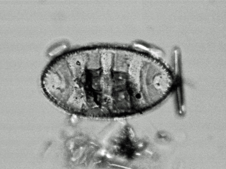 Cymatopleura elliptica Cymatopleura elliptica
