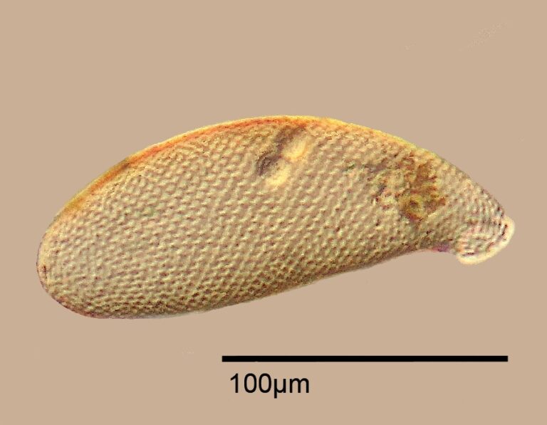 Cyphoderia ampulla Cyphoderia ampulla