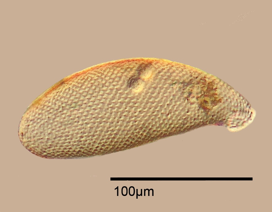Cyphoderia ampulla