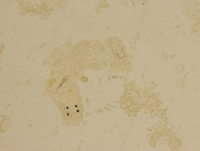 Dactylogyrus vastator