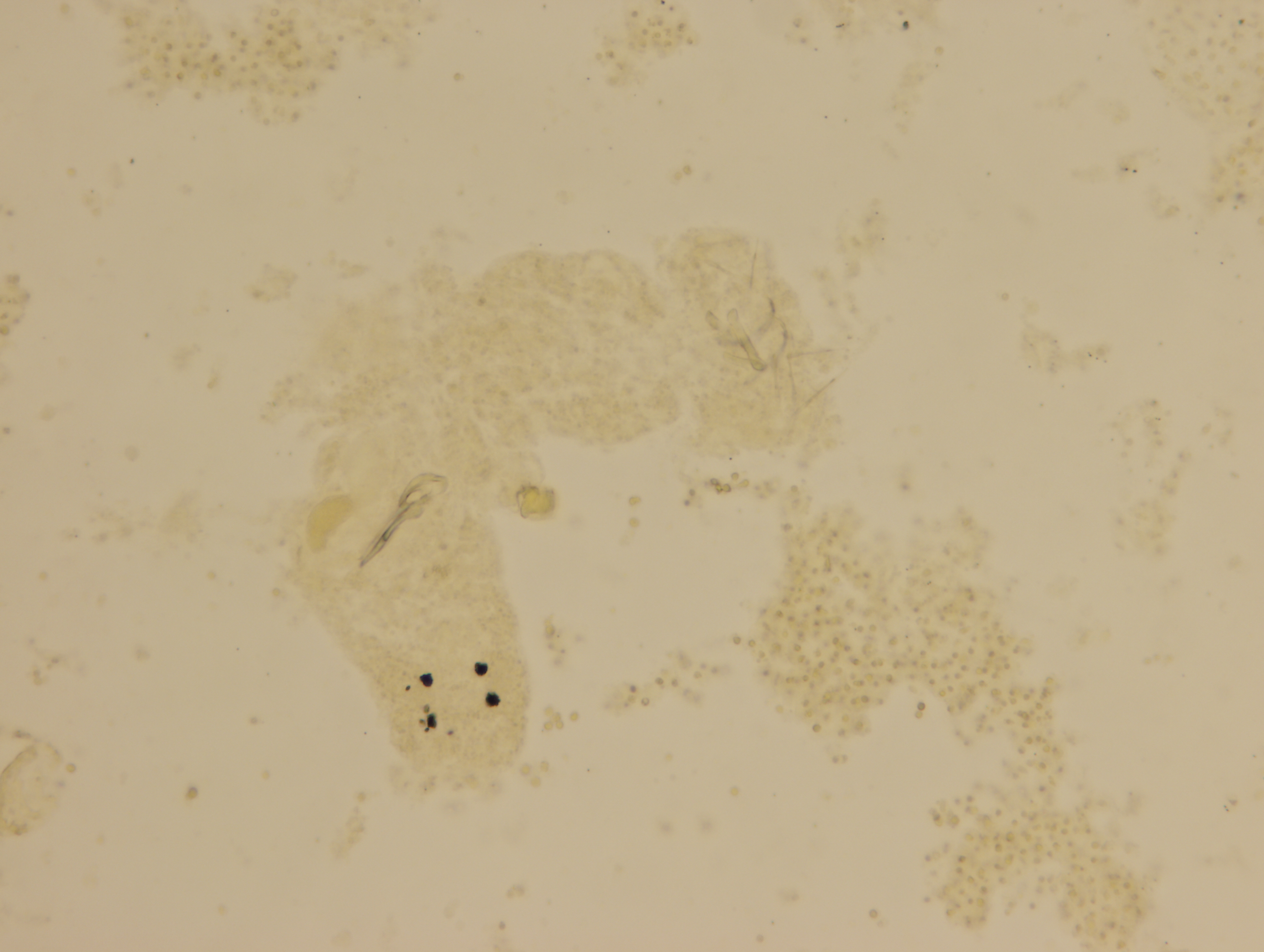Dactylogyrus vastator