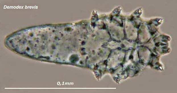 Demodex brevis Demodex brevis
