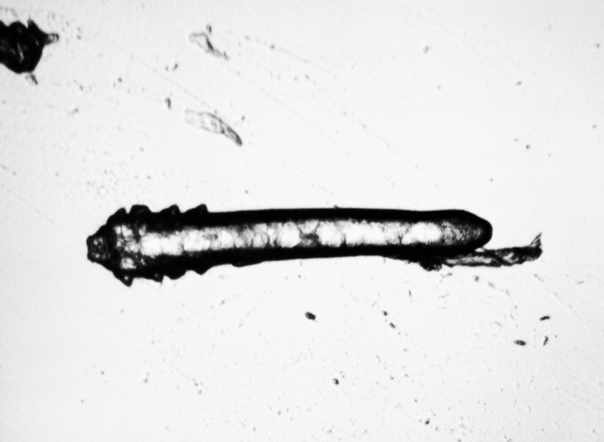 Demodex folliculorum