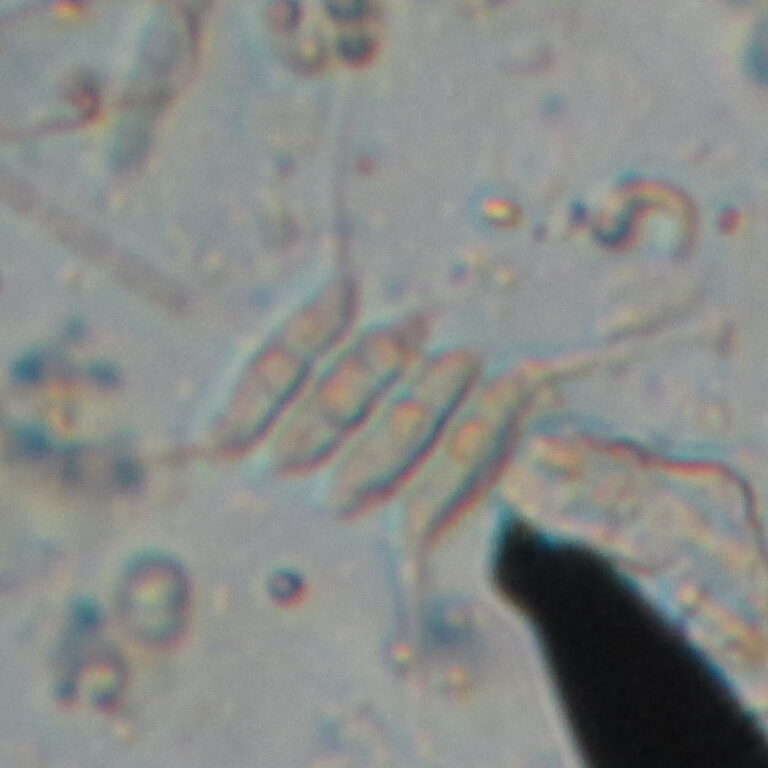 Desmodesmus armatus