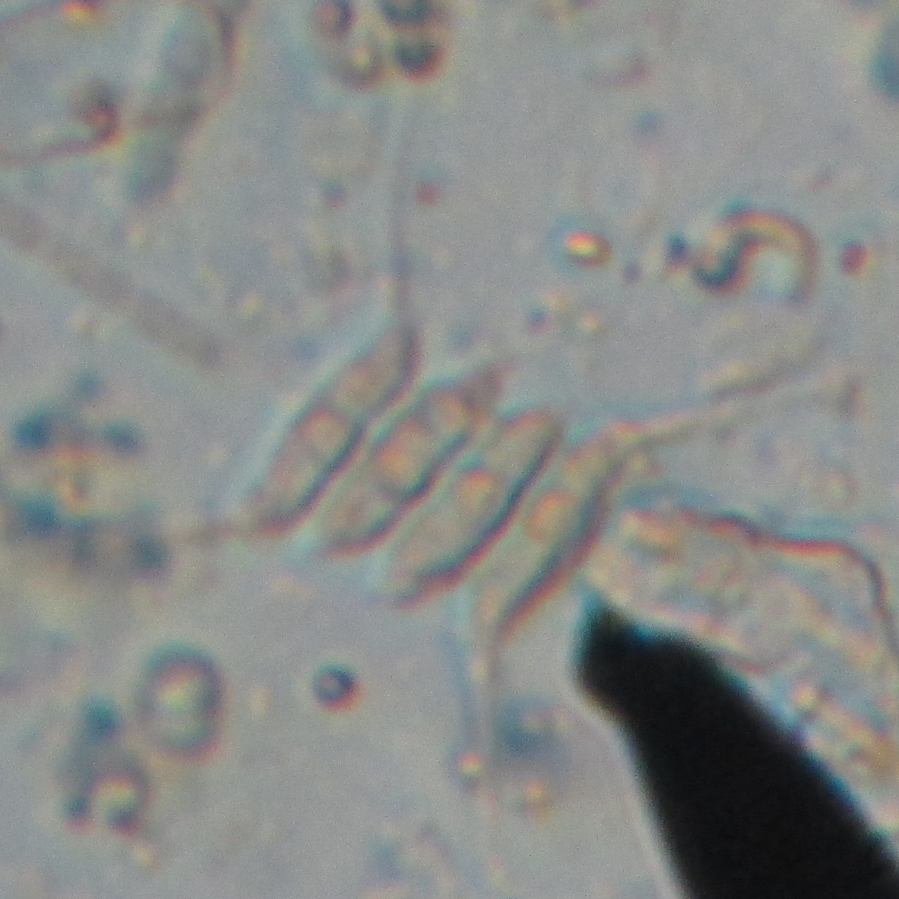 Desmodesmus armatus