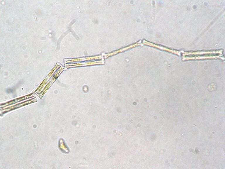 Diatoma tenuis