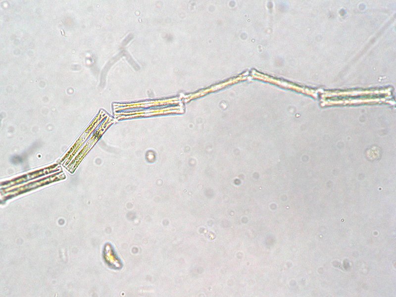 Diatoma tenuis