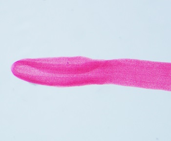Dibothriocephalus latus