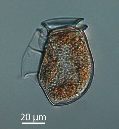 Dinophysis acuta