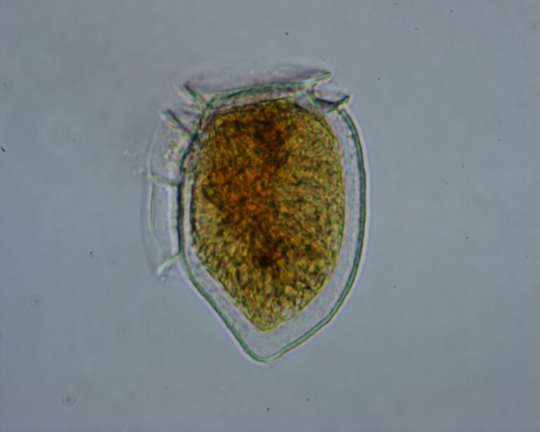 Dinophysis norvegica Dinophysis norvegica