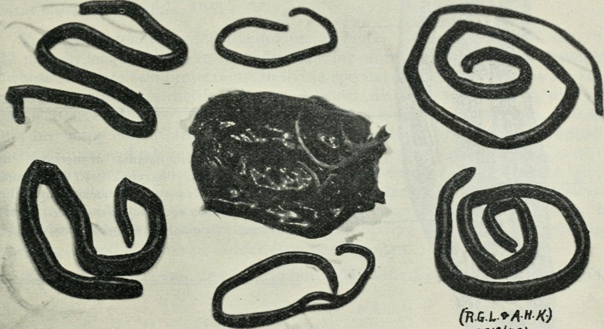 Dioctophyme renale